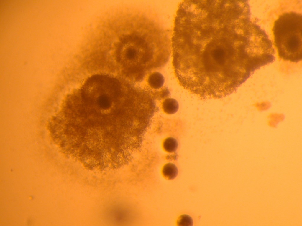 Denuded and intact oocytes in co-culture after in vitro maturation. I don't recall the magnification & my notes don't say.
